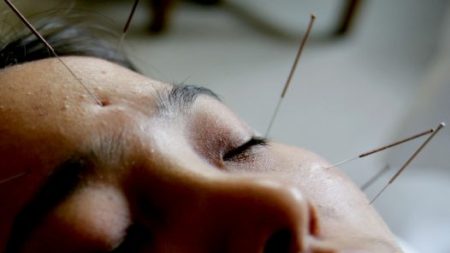 Acupuncture et médecine chinoise pour la santé mentale (I)