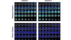 Le cerveau a une empreinte unique permettant de l’identifier