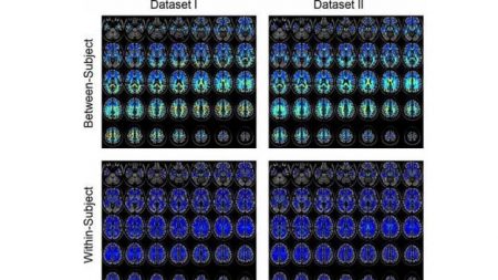 Le cerveau a une empreinte unique permettant de l’identifier