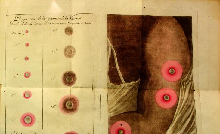 Le vaccin de la vaccine. Image de la Bibliothèque nationale de Colombie.