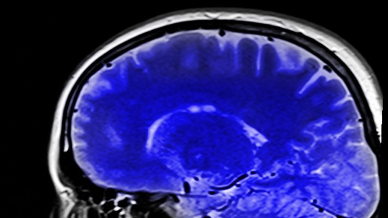 Cliché du cerveau obtenu par IRM.
Kai Stachowiak