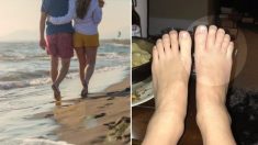 Des dizaines de vers s’introduisent dans les pieds sans chaussures d’un couple pendant leurs vacances sur une plage des Caraïbes