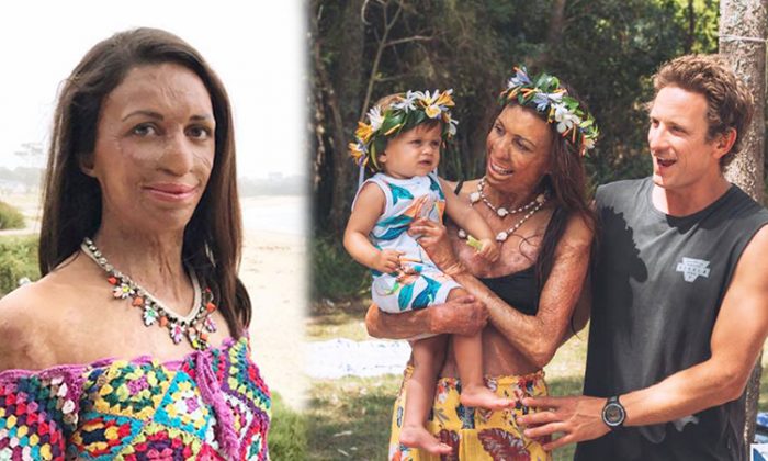 (Facebook | Turia Pitt)
