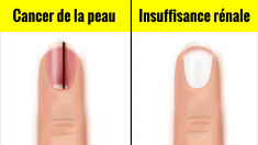 Voici 10 aspects de vos ongles qui peuvent aider à vous renseigner sur votre santé