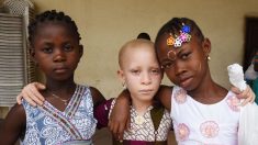 Burundi: découverte du corps démembré d’un jeune albinos