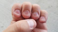 Ceux qui se rongent les ongles ne sont pas juste nerveux mais ont une personnalité particulière