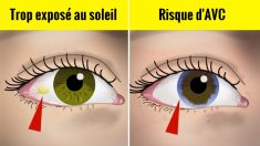 Voici 10 signes et symptômes oculaires que vos yeux révèlent sur votre santé