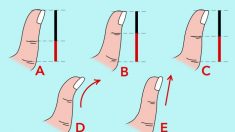 La forme de votre pouce peut révéler des choses intéressantes sur votre vie et votre personnalité