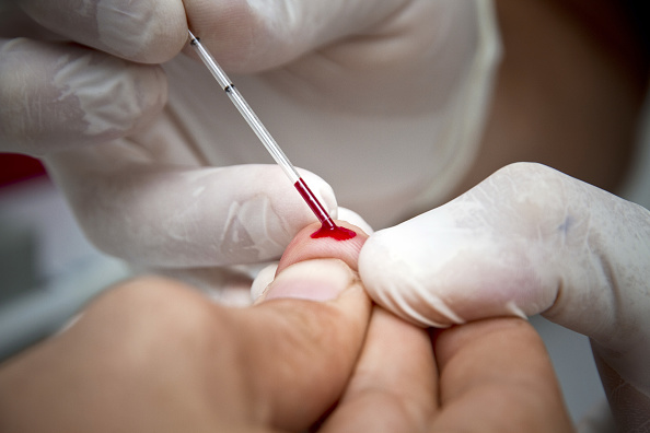 -Médecins du monde propose, depuis le 9 février 2010, des Tests de dépistage rapide du VIH aux consultants de son CASOM en dehors du cadre réglementaire actuel. Photo JODY AMIET/AFP via Getty Images.