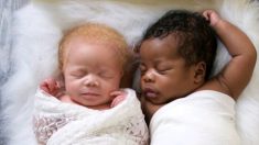 Une photographe donne naissance à des jumeaux, l’un noir, l’autre blanche, et prend de superbes photos de sa fille albinos