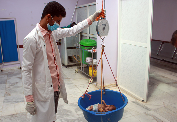 -Un enfant yéménite souffrant de malnutrition est pesé dans un centre de traitement dans la province de Hajjah, au nord du Yémen, le 5 juillet 2020. Photo par ESSA AHMED / AFP via Getty Images.