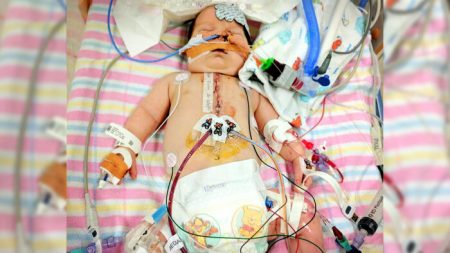 Un enfant atteint d’une rare malformation cardiaque et cliniquement « décédé » 9 fois, est toujours là et souriant auprès de sa famille