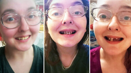 Une femme partage des photos effrayantes de caries dentaires survenues après trois ans de consommation de boissons gazeuses et d’absence de brossage