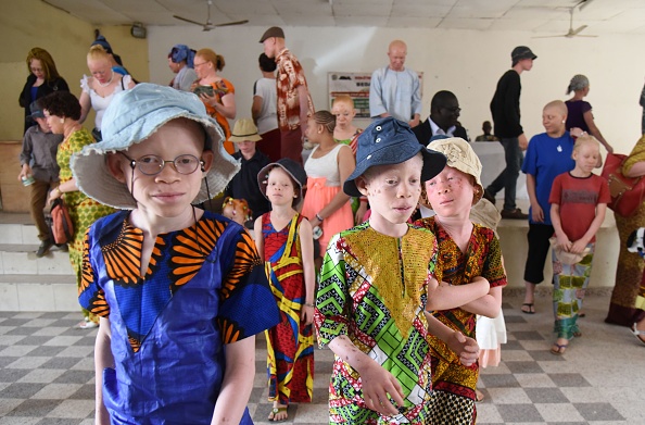 -Des enfants albinos assistent à une distribution de lunettes de soleil et de crème solaire. Photo SIA KAMBOU/AFP via Getty Images.