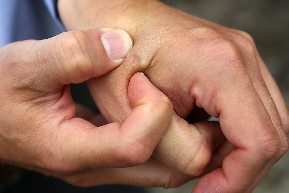 Implant sous-cutané placé entre le pouce et l’index.  (ADAM BERRY/AFP via Getty Images)