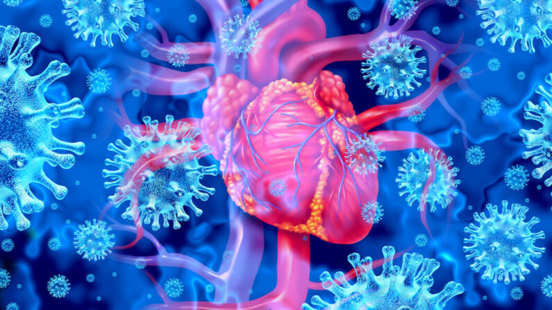 La myocardite réduit la capacité du cœur à pomper le sang et provoquent des rythmes cardiaques rapides ou anormaux potentiellement mortels. (Par Lightspring)
