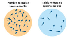 Le taux de spermatozoïdes diminue à un rythme accéléré, selon une nouvelle méta-analyse