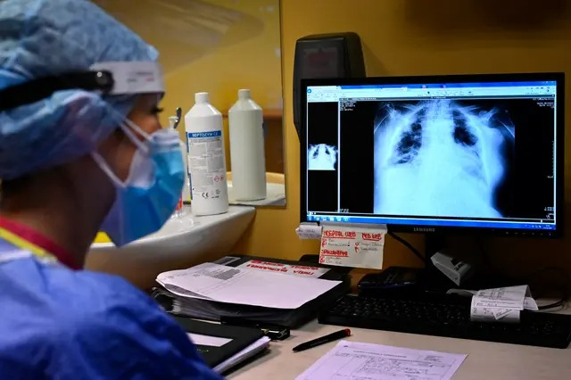 Une infirmière examine les radiographies des poumons d'un patient atteint du Covid-19 à l'hôpital de Casalpalocco, au sud de Rome, en Italie, le 13 octobre 2021. (Alberto Pizzoli/AFP via Getty Images)