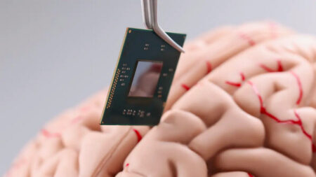 Les implants cérébraux d’Elon Musk arrivent à grands pas : quels sont les risques ?