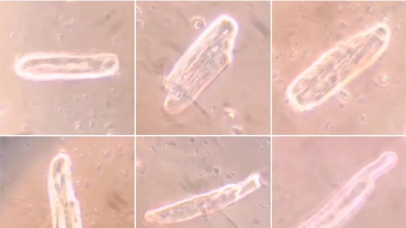 Contractions d'une cellule musculaire cardiaque ordinaire (en haut à gauche) et de cellules musculaires cardiaques 48 heures après l'administration des vaccins contre Covid-19 mRNA. (photo Rolf Schreckenberg)