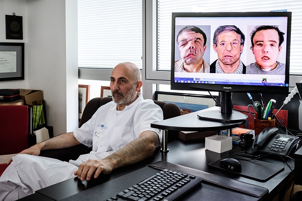 Le professeur de médecine Laurent Lantieri, spécialiste des greffes de mains et de visages, pose à côté d'un écran montrant les différentes étapes de l'opération de Jérôme Hamon, le 13 avril 2018 à l'hôpital européen Georges-Pompidou à Paris.(Photo PHILIPPE LOPEZ/AFP via Getty Images)