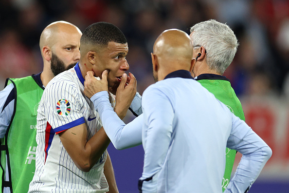 Kylian Mbappé encore décisif, est sorti dans les arrêts de jeu le nez en sang, après un choc avec un défenseur autrichien,
le 17 juin 2024 à Dusseldorf en Allemagne. (Photo Dean Mouhtaropoulos/Getty Images)