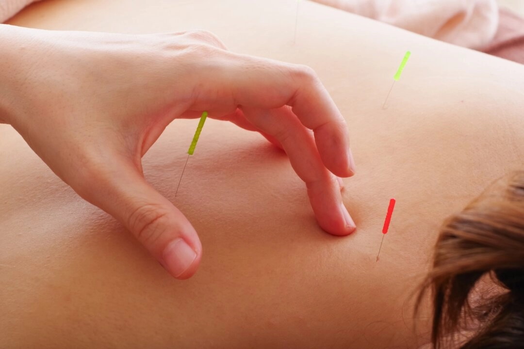 L'acupuncture s'avère efficace contre la sciatique