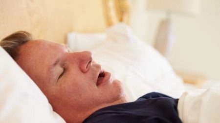 L’apnée du sommeil est liée à des modifications structurelles du cerveau