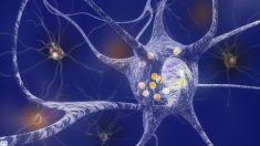 Cinq exercices ciblés pour aider à gérer la maladie de Parkinson (« Exercices faciles pour combattre les maladies chroniques », 2e partie)